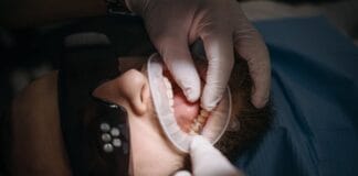 Compare Root Canal Procedures Across Public And Private Clinics