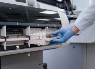 Why Precision Beats Speed: A Leadership Lesson From Automated Labs
